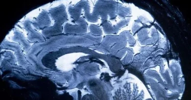 OMS pede atenção urgente à saúde cerebral