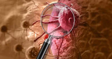 Brasil deve ter 781 mil novos casos de câncer por ano entre 2026 e 2028
