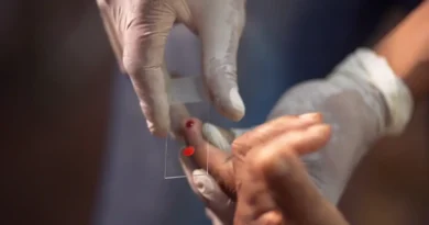 SUS começa a usar novo tratamento contra a malária em crianças